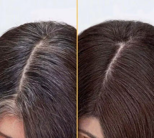 Shampoo Chao Canas® Original + Exfoliante de regalo